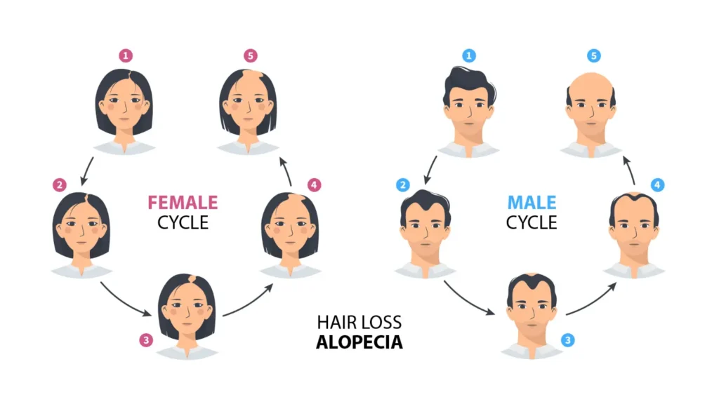 Alopecia